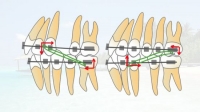 [ FreeCourseWeb ] Udemy - Orthodontic biomechanics and anchorage