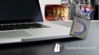 [ DevCourseWeb ] Udemy - Introduction to Orthodontic Biomechanics